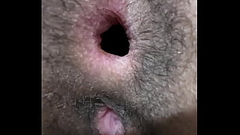 Anal gape Thumb